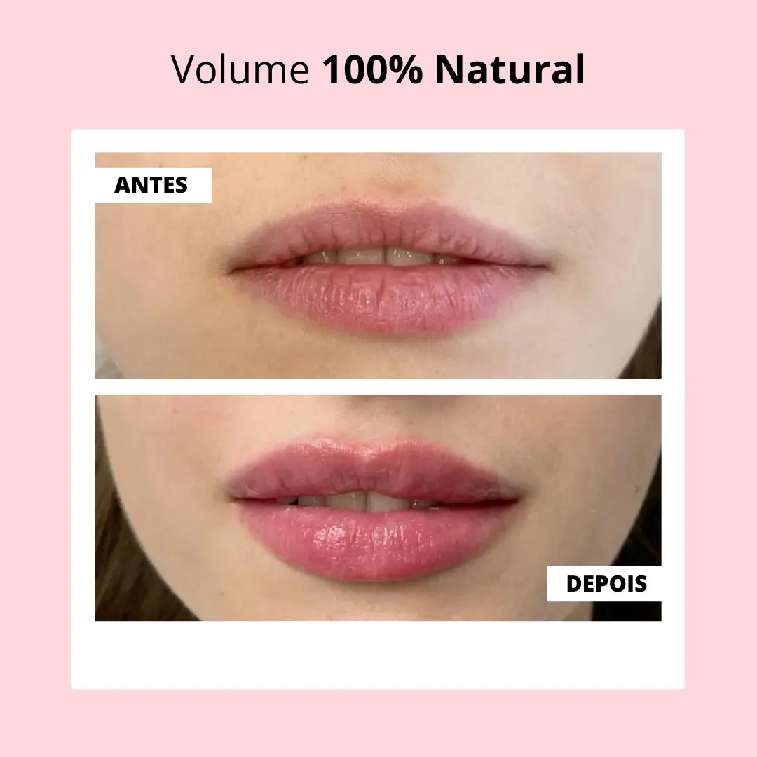 Lip Booster KIT | Lábios Volumosos Naturalmente + Guia Exclusivo