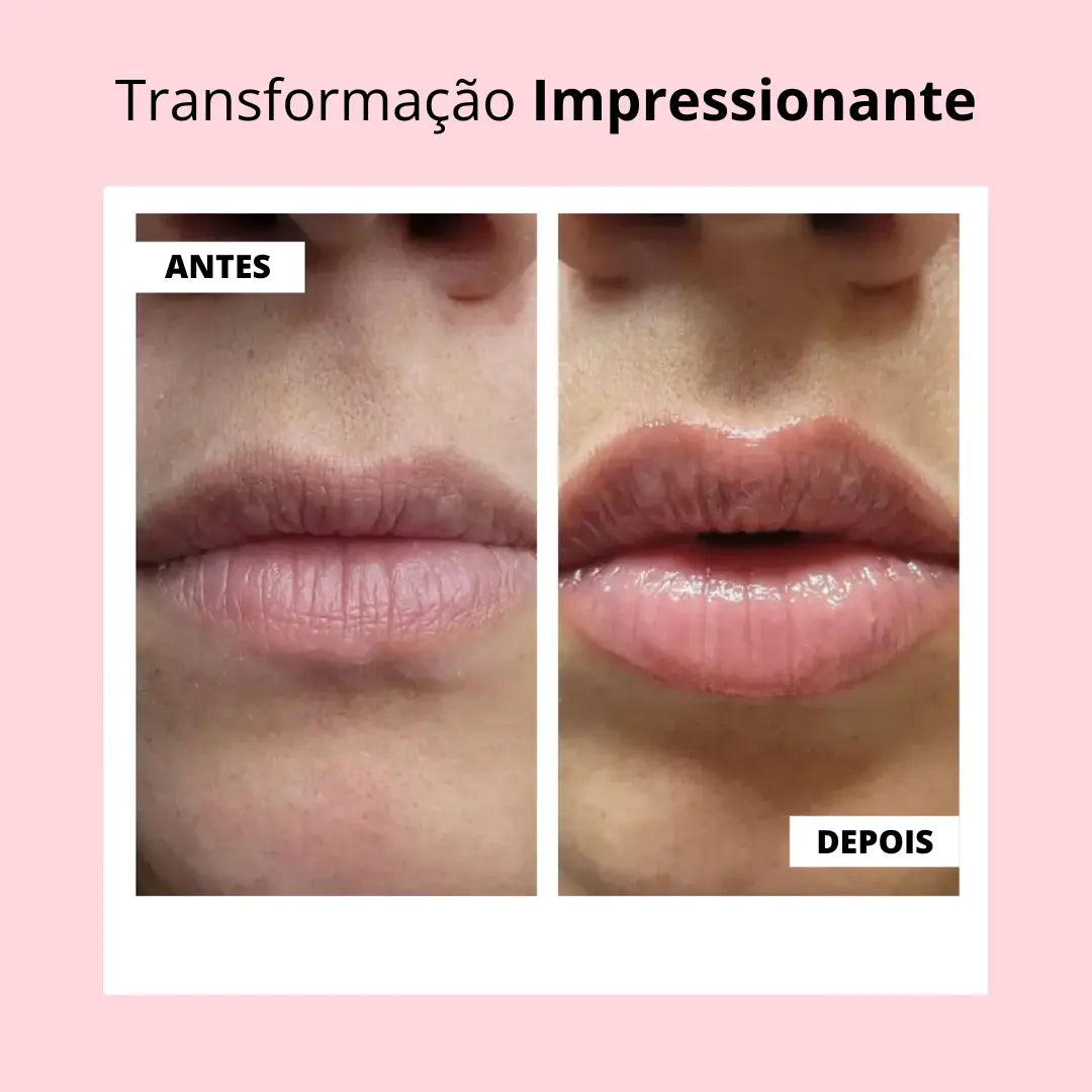 Lip Booster KIT | Lábios Volumosos Naturalmente + Guia Exclusivo