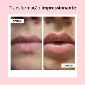 Lip Booster KIT | Lábios Volumosos Naturalmente + Guia Exclusivo