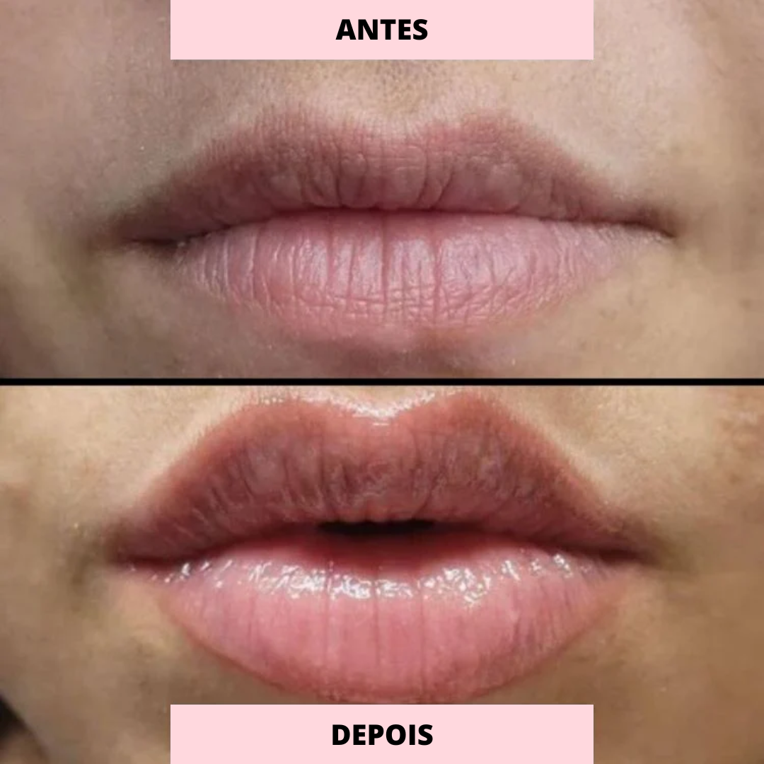 Lip Booster | Lábios Naturais e Preenchidos + Guia Exclusivo